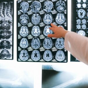 Google AI Hataları: Sağlıkta Yapay Zeka Riskleri ve Çözümleri