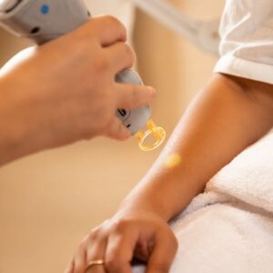 Braun Skin iExpert Smart IPL: Evde Lazer Epilasyon
